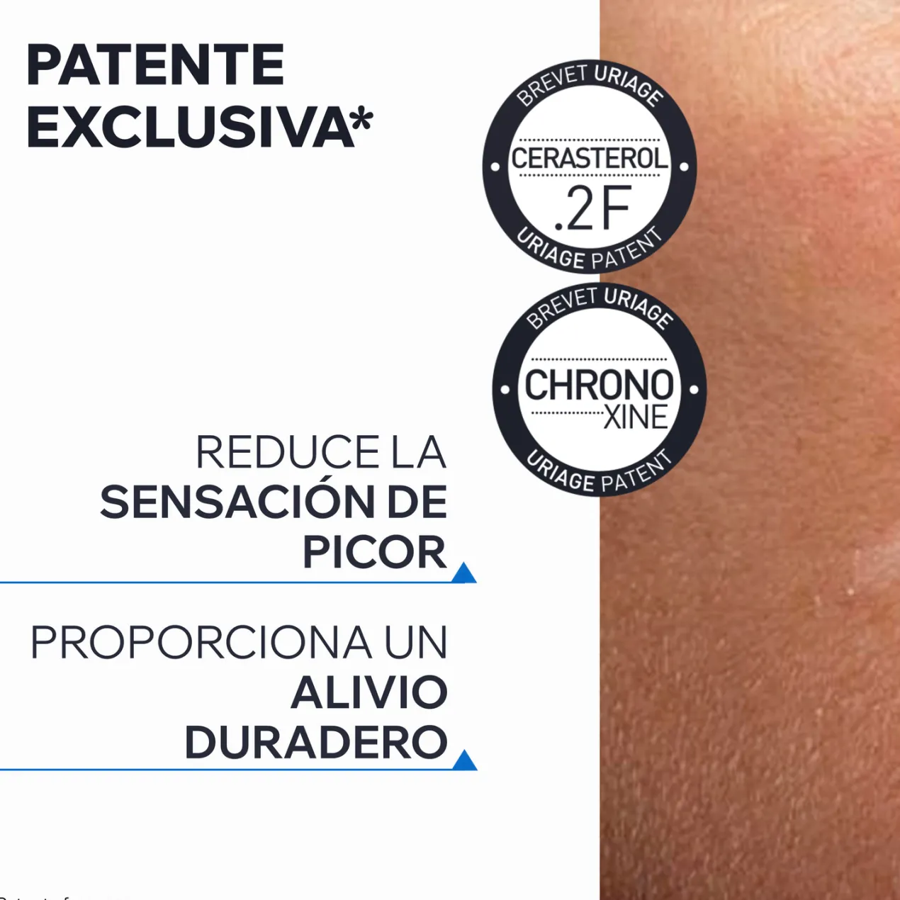 Xemose C8+ Cerato Relipidizante Anti-picor