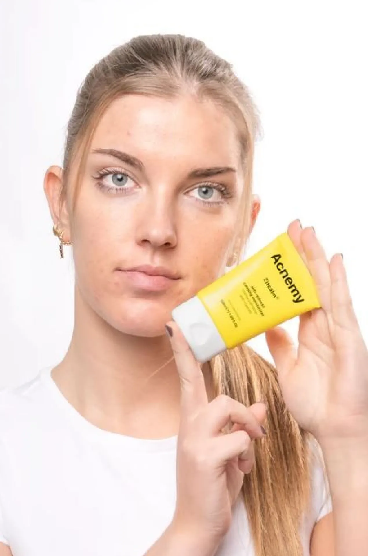 Zitcalm Crema Calmante Anti-Rojeces